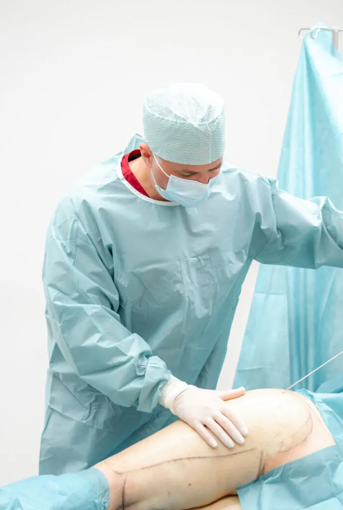 Liposuktion bei Lipödem in Lokalanästhesie